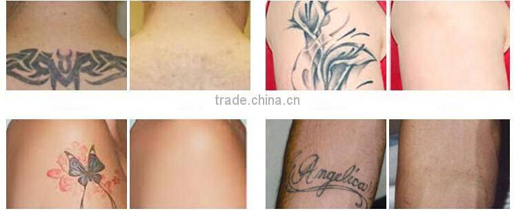 permanent make up machine accurate results Medical CE approve