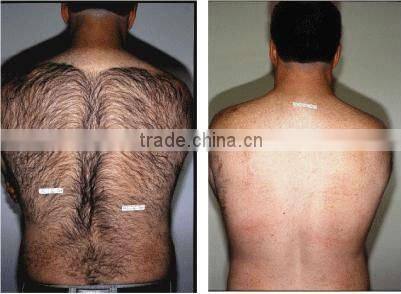 Professional IPL hair removal beauty machine AP-TK