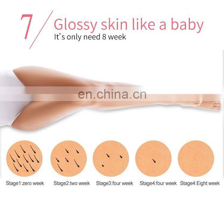 Portable Ipl laser epilator hair loss removal machine IPL Hair Removal