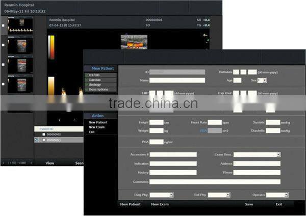 Medical color doppler Ultrasound Diagnostic System, color doppler ultrasound