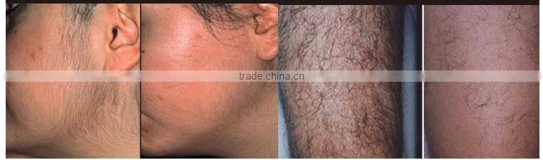 New design rotating screen 808nm diode laser hair removal machine, hair removal speed 808 permanent