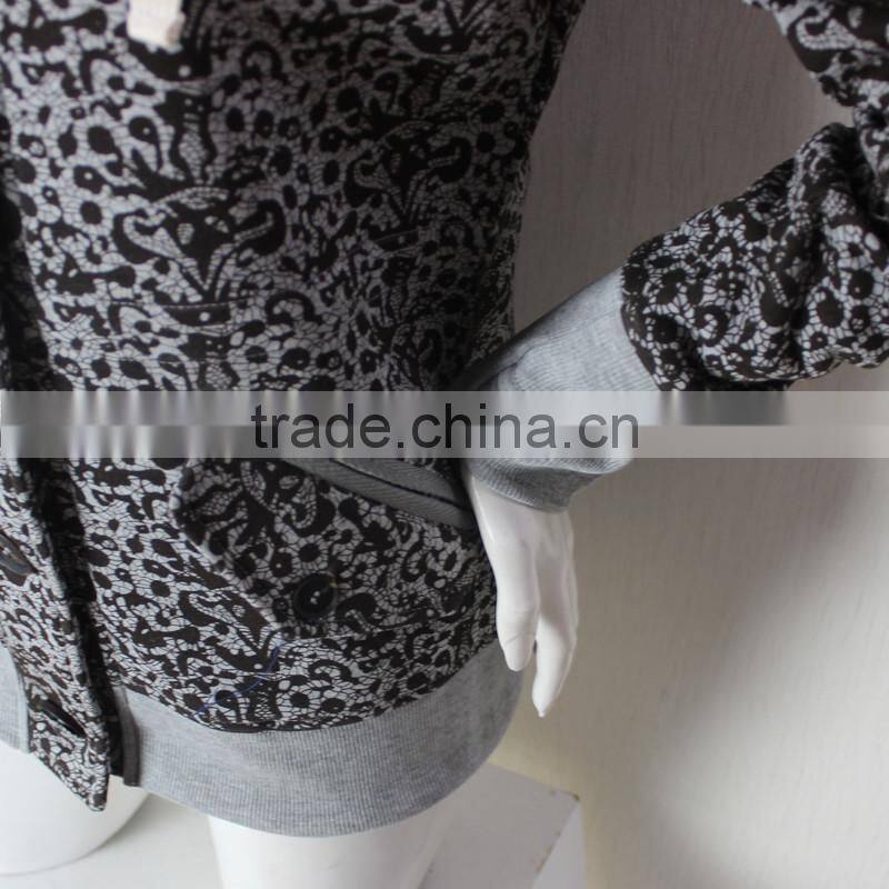 Korean Style Fashion Women Coat 2016