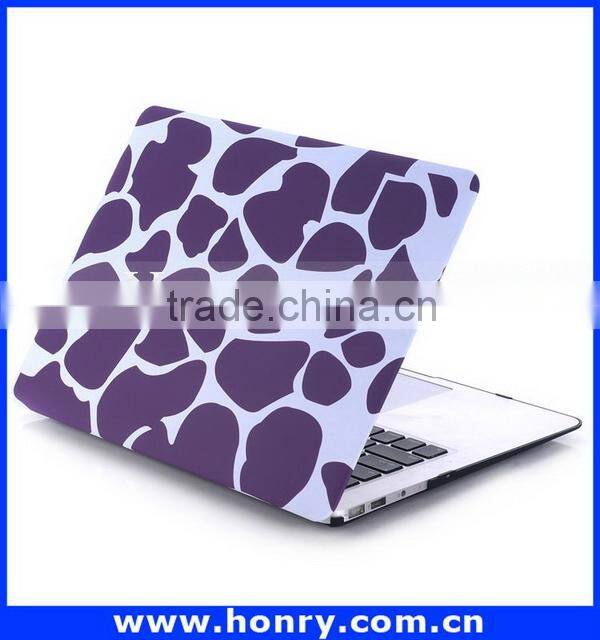 Top level Cheapest hard cover case for macbook air 11