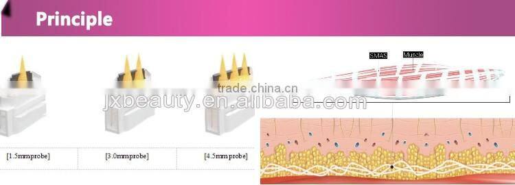 6kg portable face lifting machine prices hifu CE approval