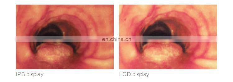 Automatic white balance adjustment LED lamp video endoscopy equipment for veterinary