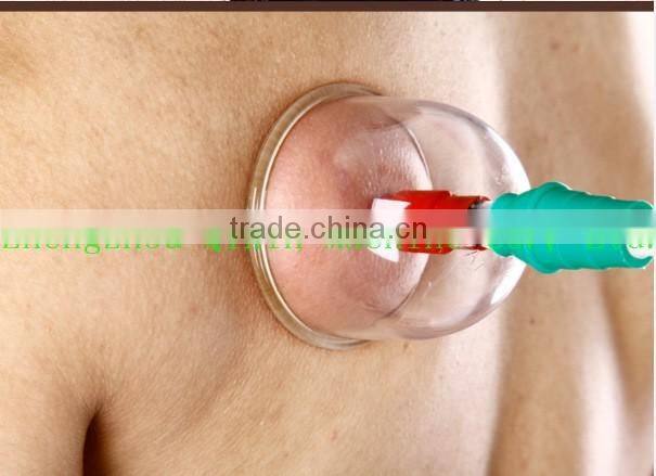cupping hijama cups