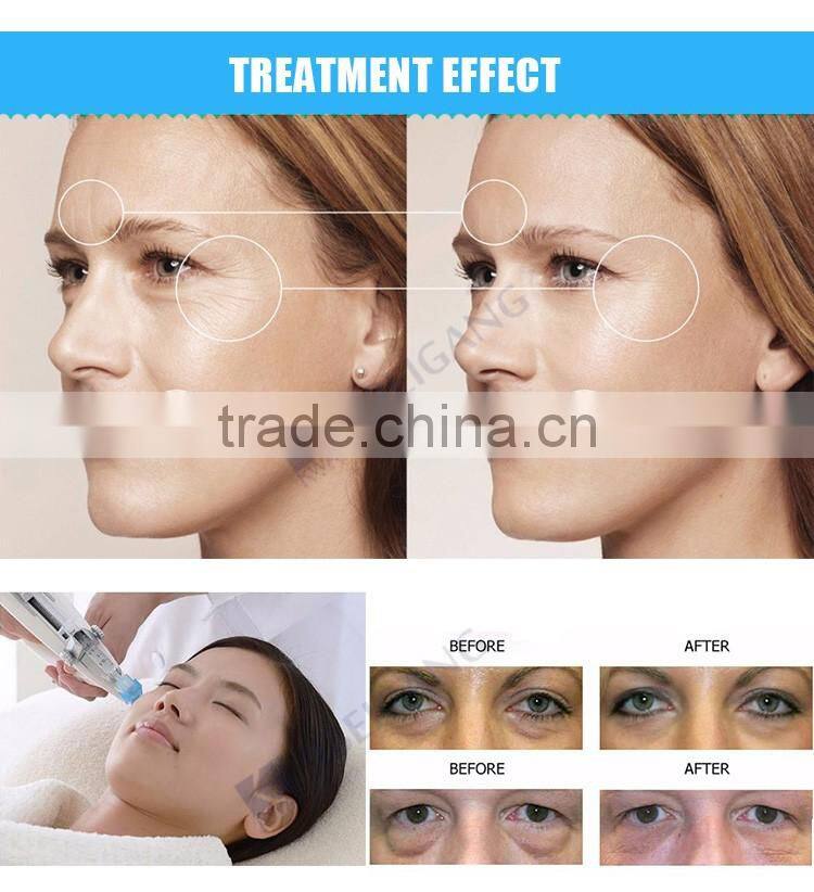 Professional skin whitening portable mesotherapy injection meso gun price