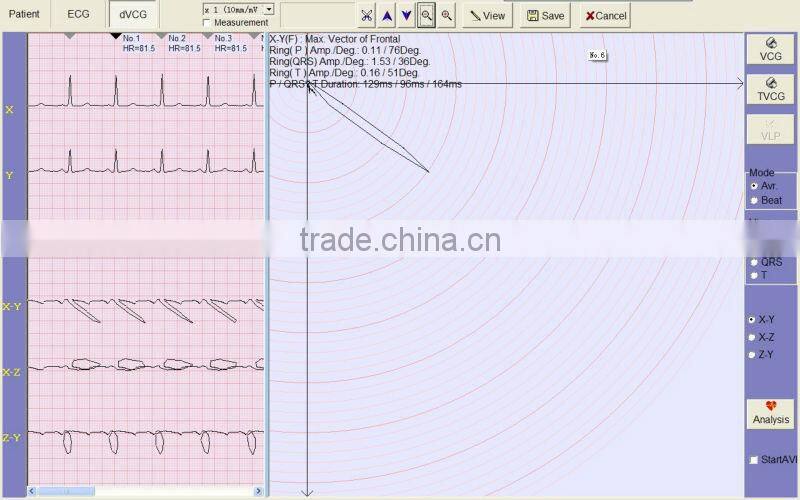 High-Quality Disposable Automatic Measurement Auto Handheld Cheap 3 Channels ECG Machine