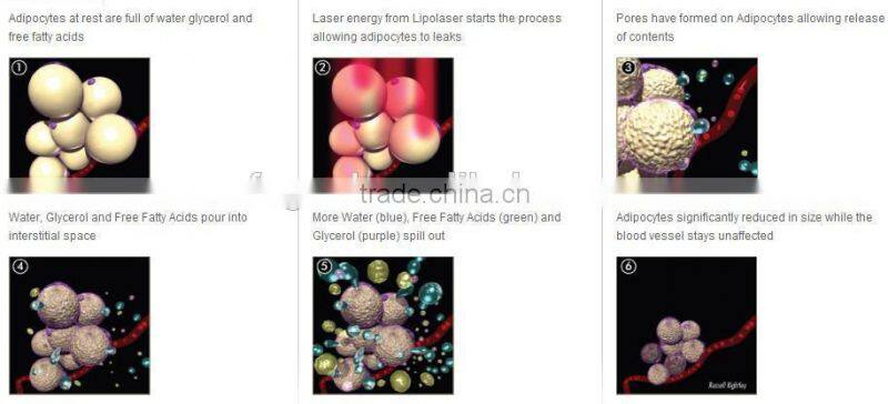 Medical Equipment Beauty Salon Lipo Laser Slimming Machine Fast Cellulite Loss machine for sale