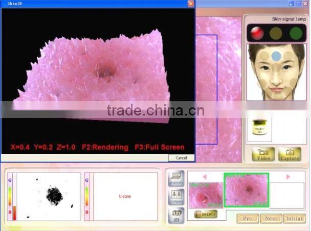 Magic mirror skin analyzer Skin scope analyzer