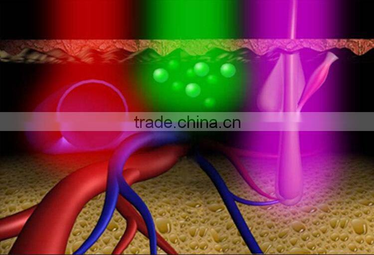 2014 diode laser soprano hair removal system 808 dilas 808 nm diode bar