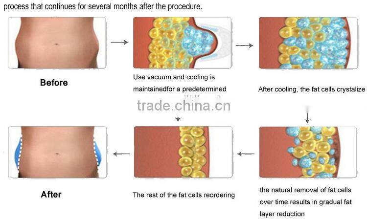 Wholesale Alibaba Mini Portable Cryotherapy Machine for Burning Fat