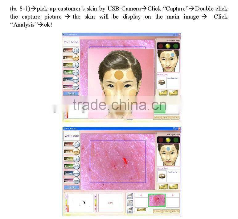 hot sale visia skin analysis machine HT-907