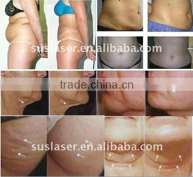 Cavitation RF Ultrasonic Vacuum Machine S80C ISO/CE Liposlim Cavitation Machine