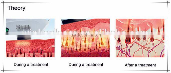 big ipl handle hand piece 12*30mm 10*40mm spot shr hair removal machine