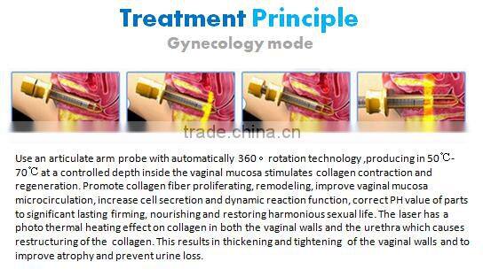 GGLT RF tube CO2 fractional laser vaginal tightening Skin rejuvenation machine price