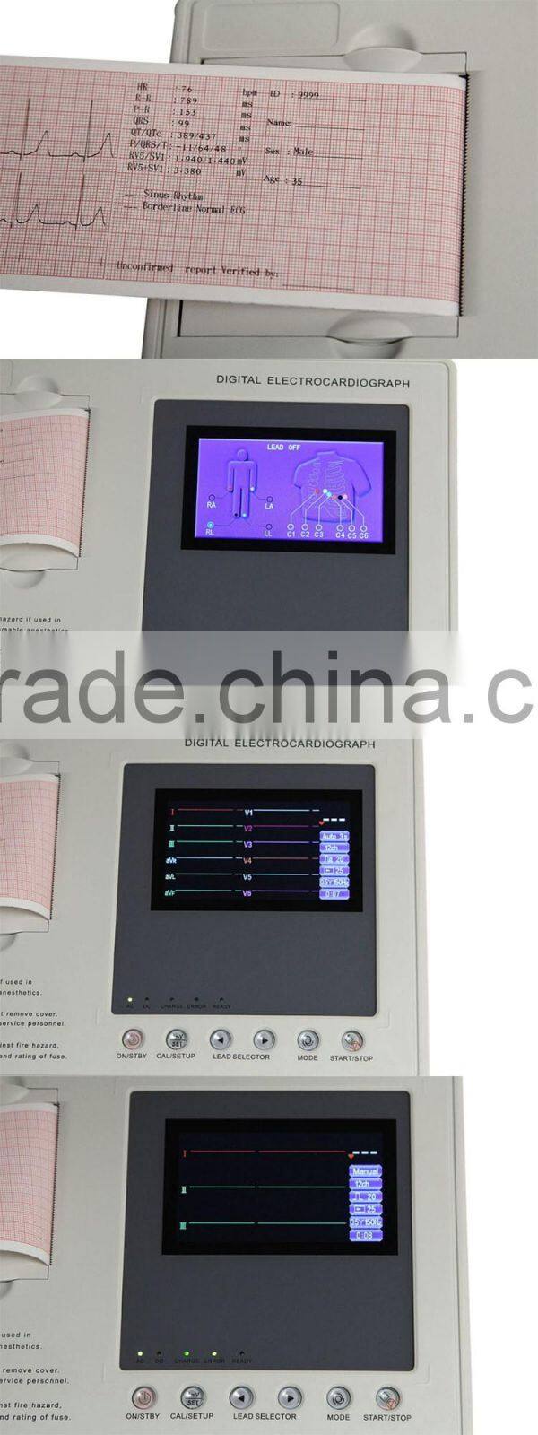 Economic Style Interpretive 3 Channel ECG Machine EKG-903A3