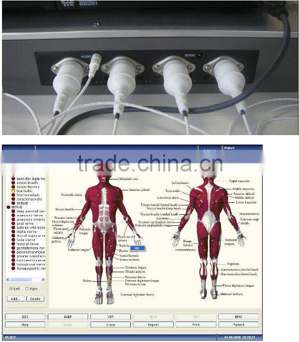 2015 CE&ISO Approved EMG EP Systems Electromyography myoelectricity Measuring System for Neurology