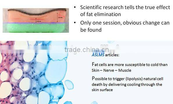 high-effective 4 in 1cavitation lipo freeze weight loss machine