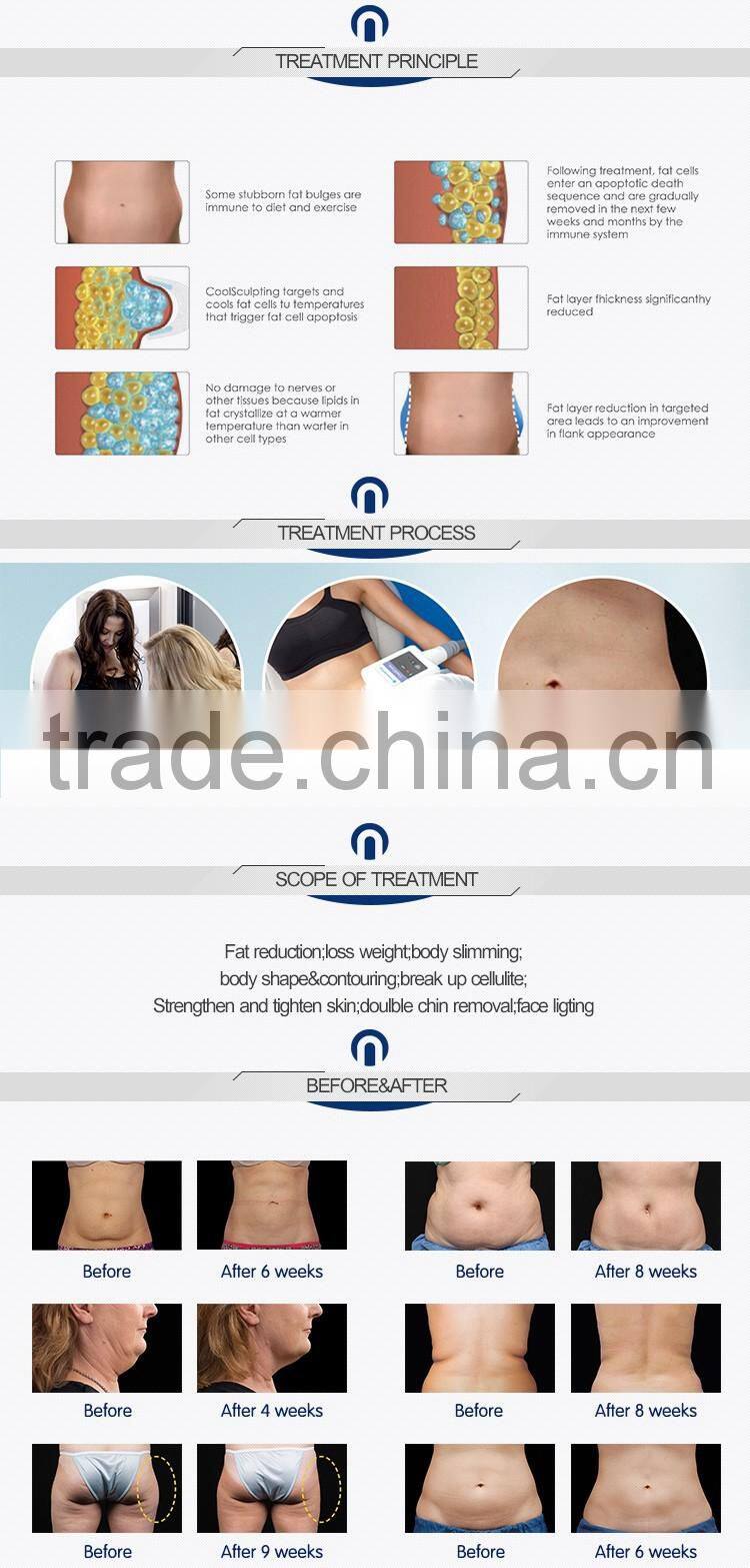 2 Handles work together!!!!! fat freezing slimming portable cryolipolysis machine