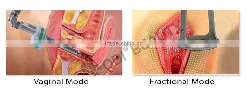 Bestsellers fractional laser co2 vaginal equipment
