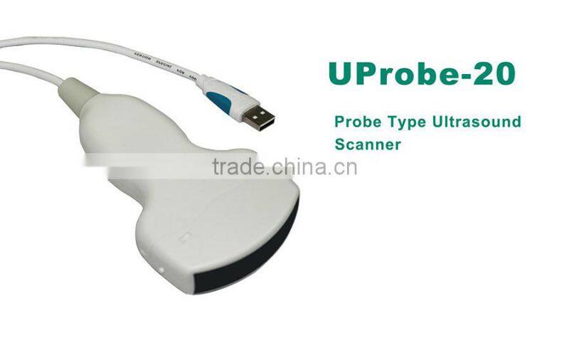 UProbe-20 Probe Type Ultrasound Scanner for laptop