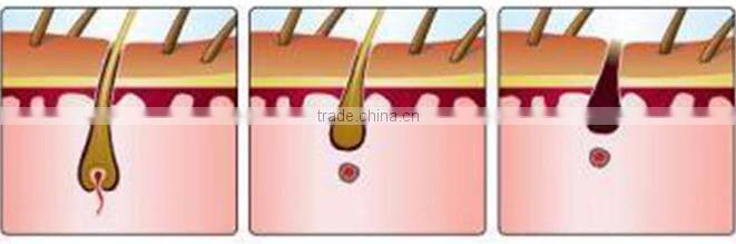 Modern Beauty Equipment!! OPT SHR IPL Machine Hair Removal Laser with Teaching Video