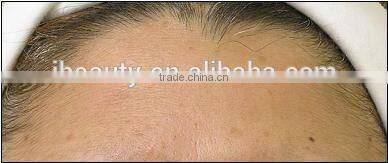 2016 New product MR16-2SB New product microneedle /needle free mesotherapy machine