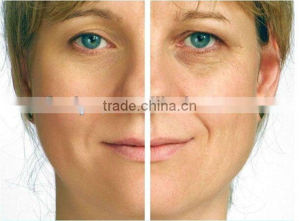 VY-F7 Radiofrequency Equipment With RF Lifting Face Beauty Machine