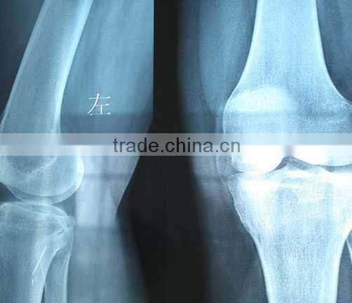 Konida Medical Dry Film, x ray film from manufacturer, KND-A/F