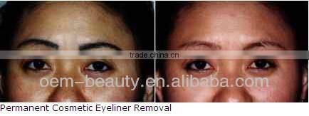 High power tatoo removal machine laser 1064/532 nm for beauty salon