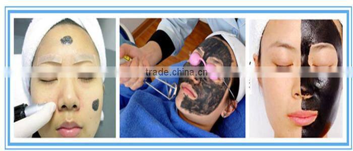 keyword:nd yag laser tattoo removal machine