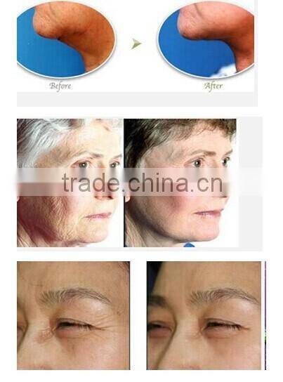 2016 FU 4.5 2S new age ultrasound