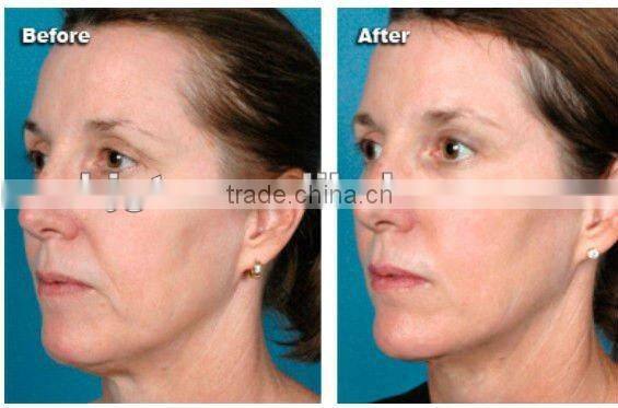 2013 hot!!!!!! Cavitation+RF+Led light slimming machine for home use