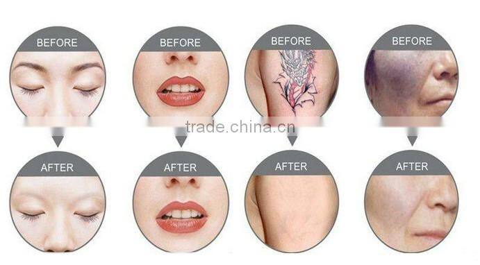 pdt skin rejuvenation led red light therapy machine