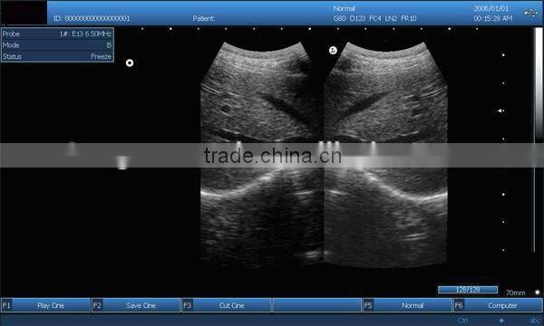 professional ultrasound devices with 3d