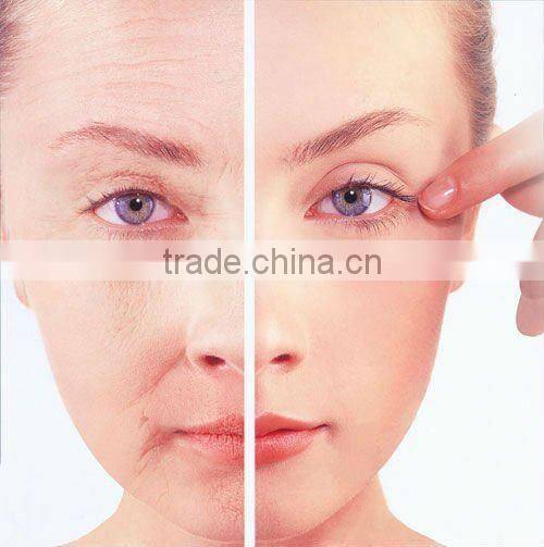 C003- Portable photon skin rejuvenation for beauty salon use