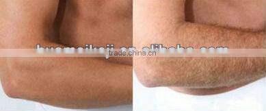 diode laser hair epilator handsets