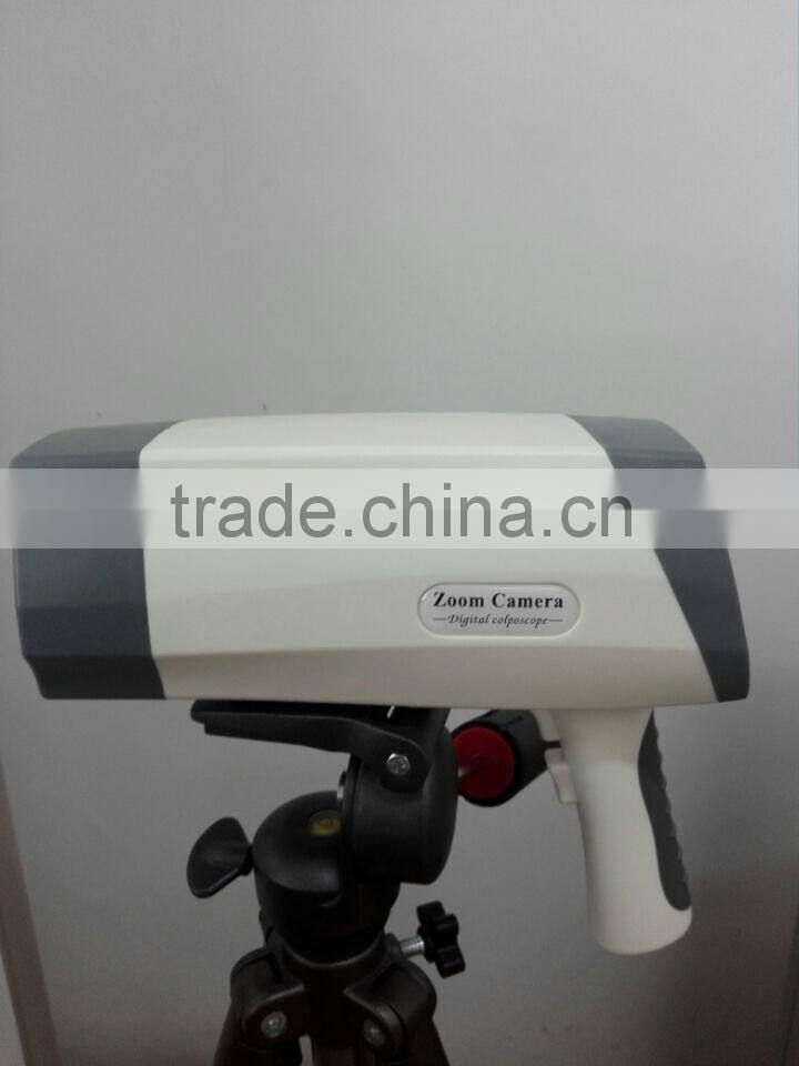 Digital Video Colposcope, Laptop Video Colposcope, Gynecology Video Colposcope