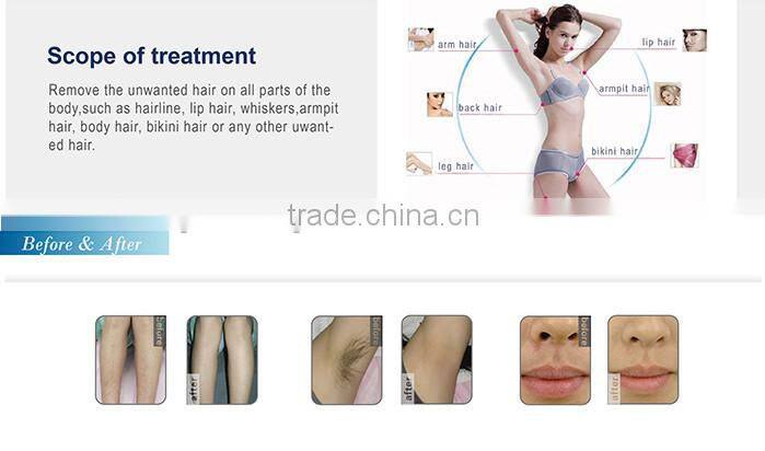 High performance epicare lamis hair removal diode laser