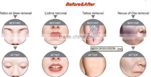 Best selling multifunctional 3 in 1 esthetics equipment