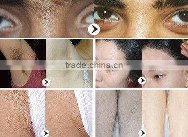 ipl laser hair removal machine for sale ipl xenon flash lamp