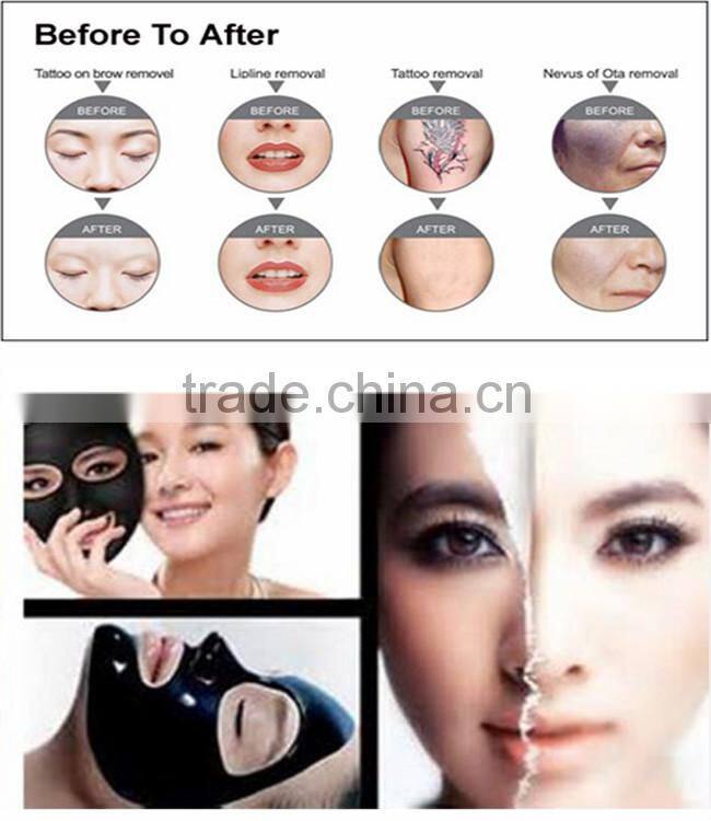 High Quality Double Rod Powerful Black Tattoo Removal