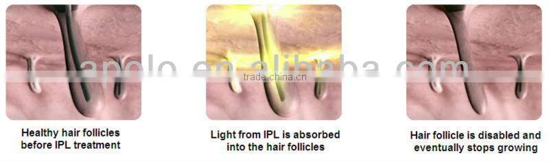 Multifunction ipl shr e-light machine with CE FDA approval