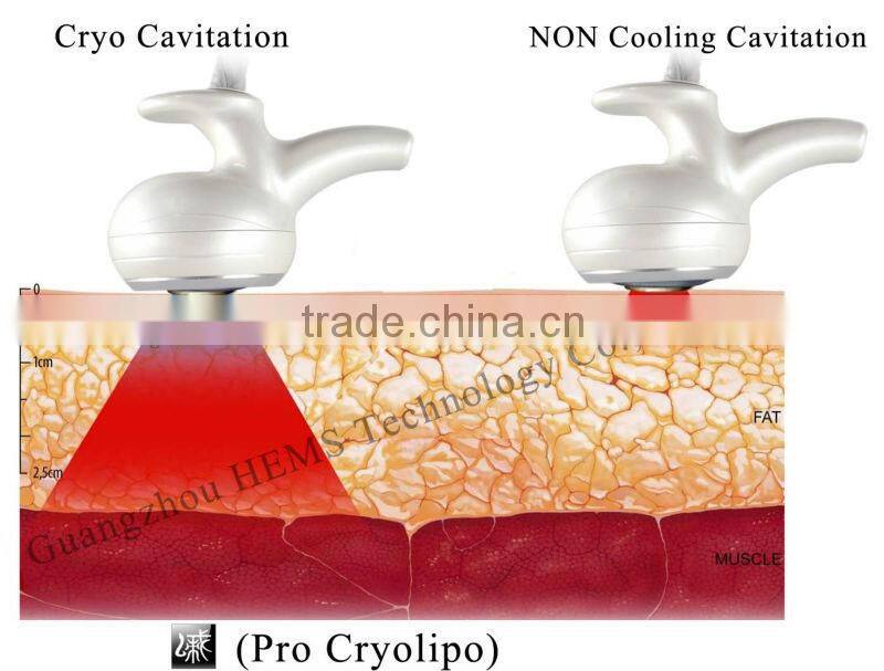 Suction Ultra Cryo Ultrasonic Cavitation Body Contouring Weight Loss Device-Pro Cryolipo