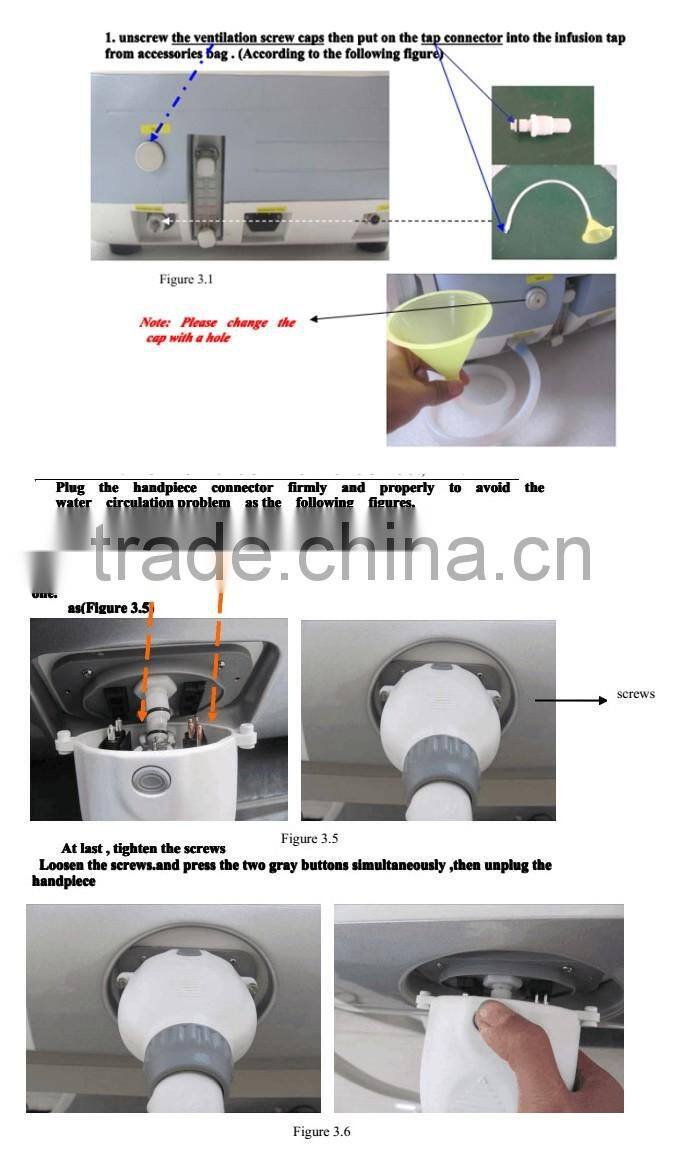 2016 Industry low prices newest technology home use mini ipl laser for hair removal