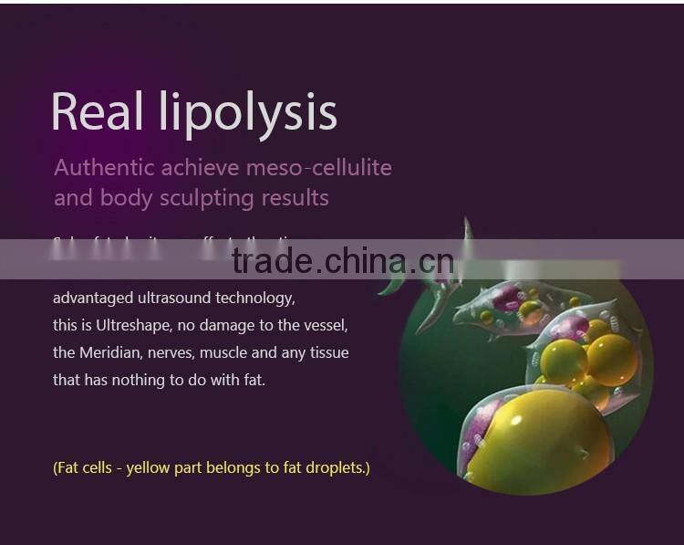 2016 ultrashape hifu body slimming machine / liposonic machine / ultrasonic ultrasound liposuction equipment for weight loss