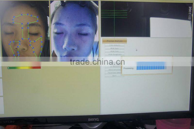 Beauty Device Magic Mirror Skin Analyzer Skin Test Machine with FDA