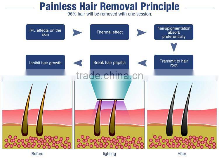 High quality most popular products for salon SHR+E-light(IPL+RF )Machine with 2 handles