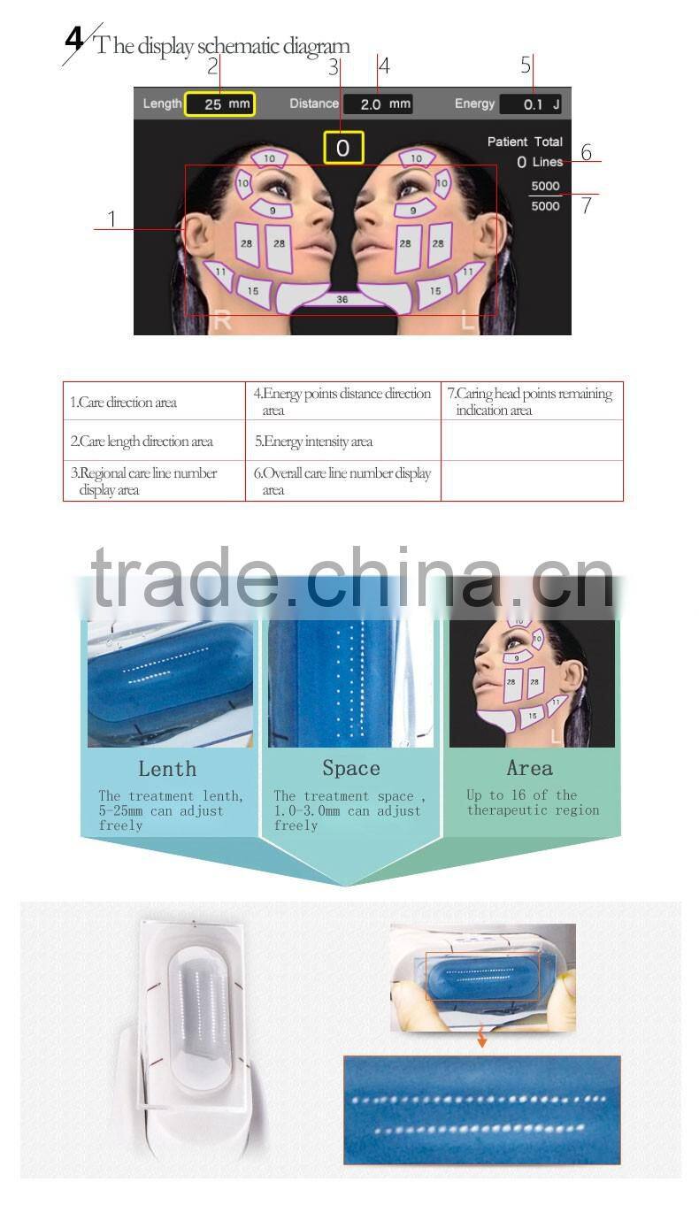 hifu wrinkle removal skin tighten hifu high intensity focused ultrasound